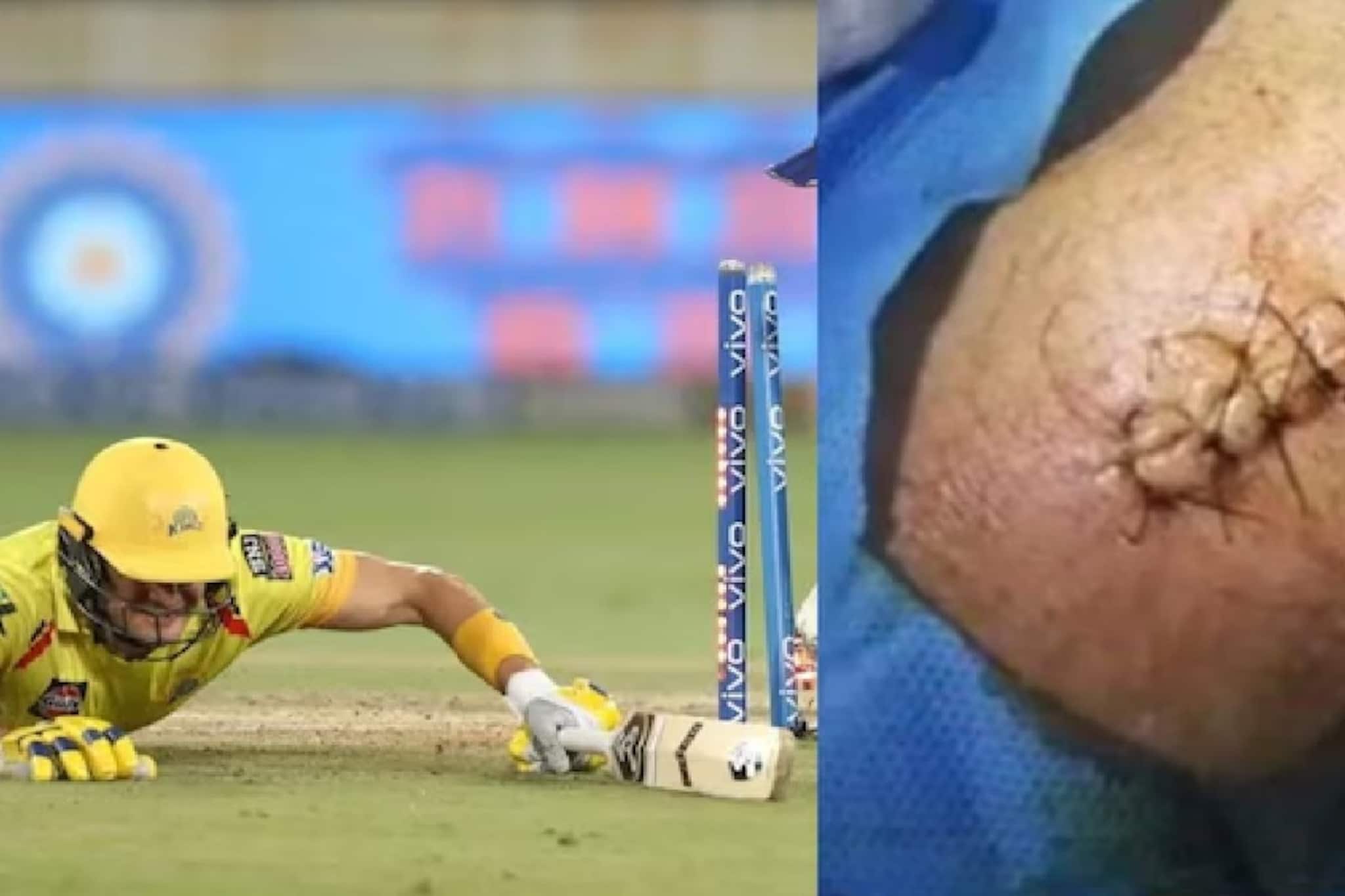 রক্তে ভেসে যাচ্ছে জার্সি! হাঁটুতে সাতটা সেলাই! আইপিএলের সব থেকে লড়াকু ইনিংস