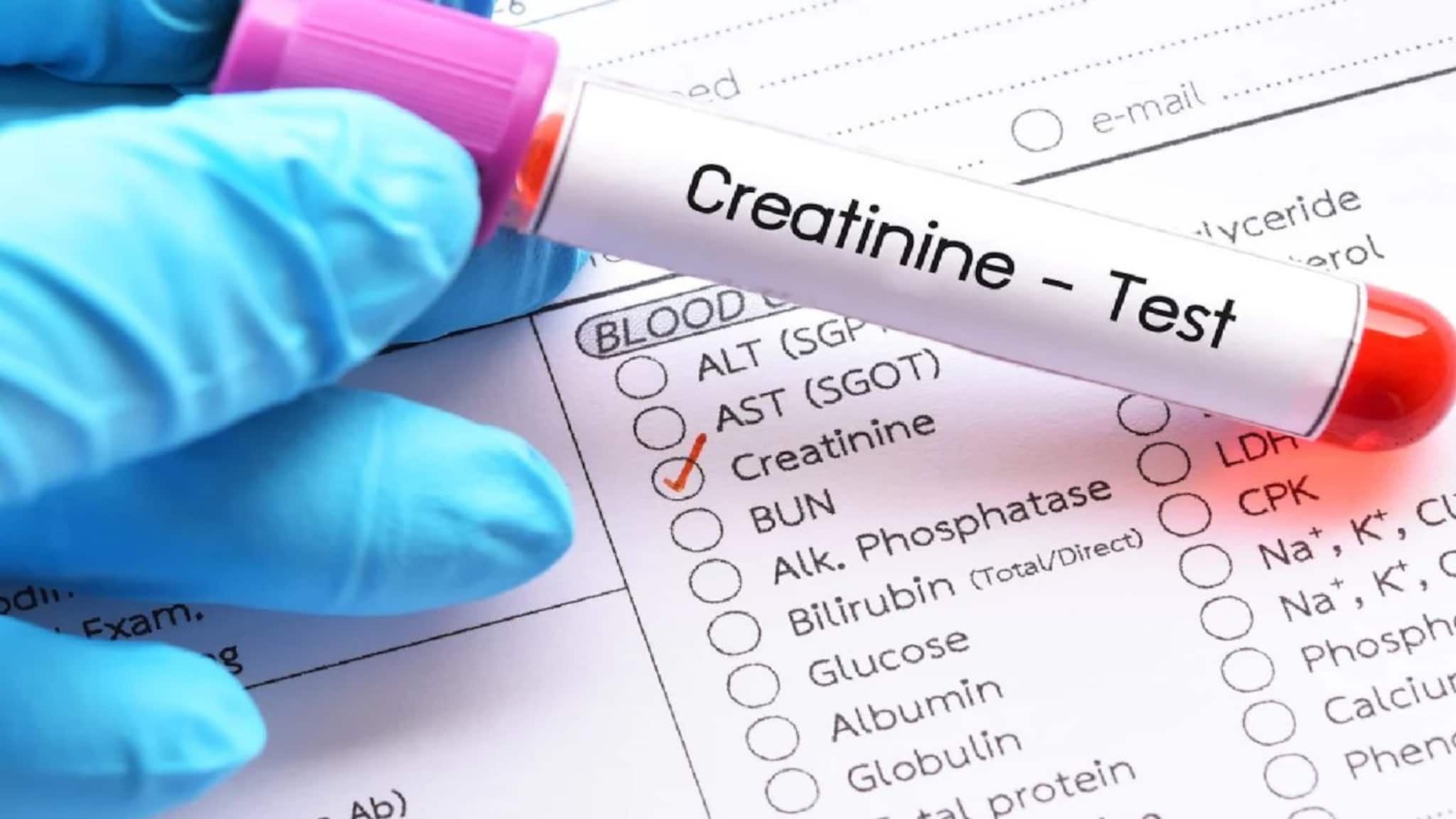 Creatinine: রক্তে 'ক্রিয়েটিনিন' বেশি মানেই নষ্ট হচ্ছে কিডনি! শরীরের কোন ৫ উপসর্গ বলে দেয় 'ক্রিয়েটিনিন' বেড়েছে? কিডনি সুস্থ রাখতে অবশ্যই জেনে নিন