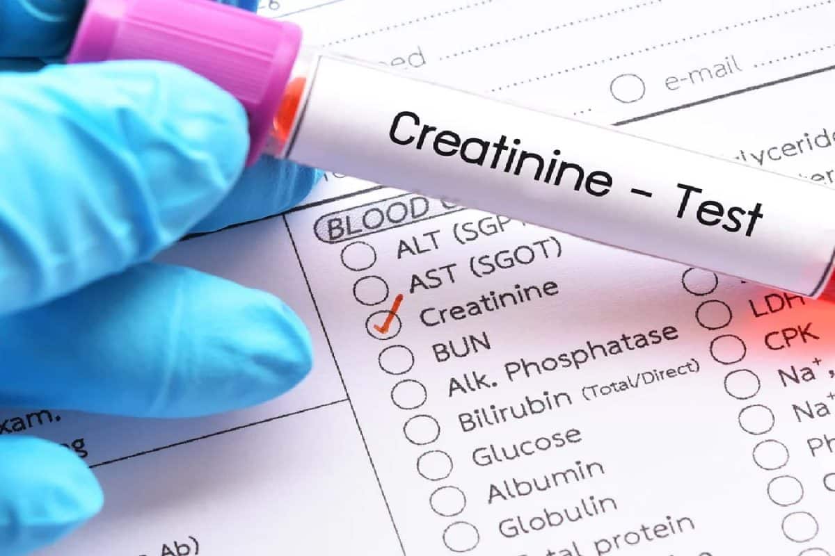 রক্তে 'ক্রিয়েটিনিন' বেশি মানেই নষ্ট হচ্ছে কিডনি! শরীরের কোন ৫ উপসর্গ বলে দেয় 'ক্রিয়েটিনিন' বেড়েছে? কিডনি সুস্থ রাখতে অবশ্যই জেনে নিন