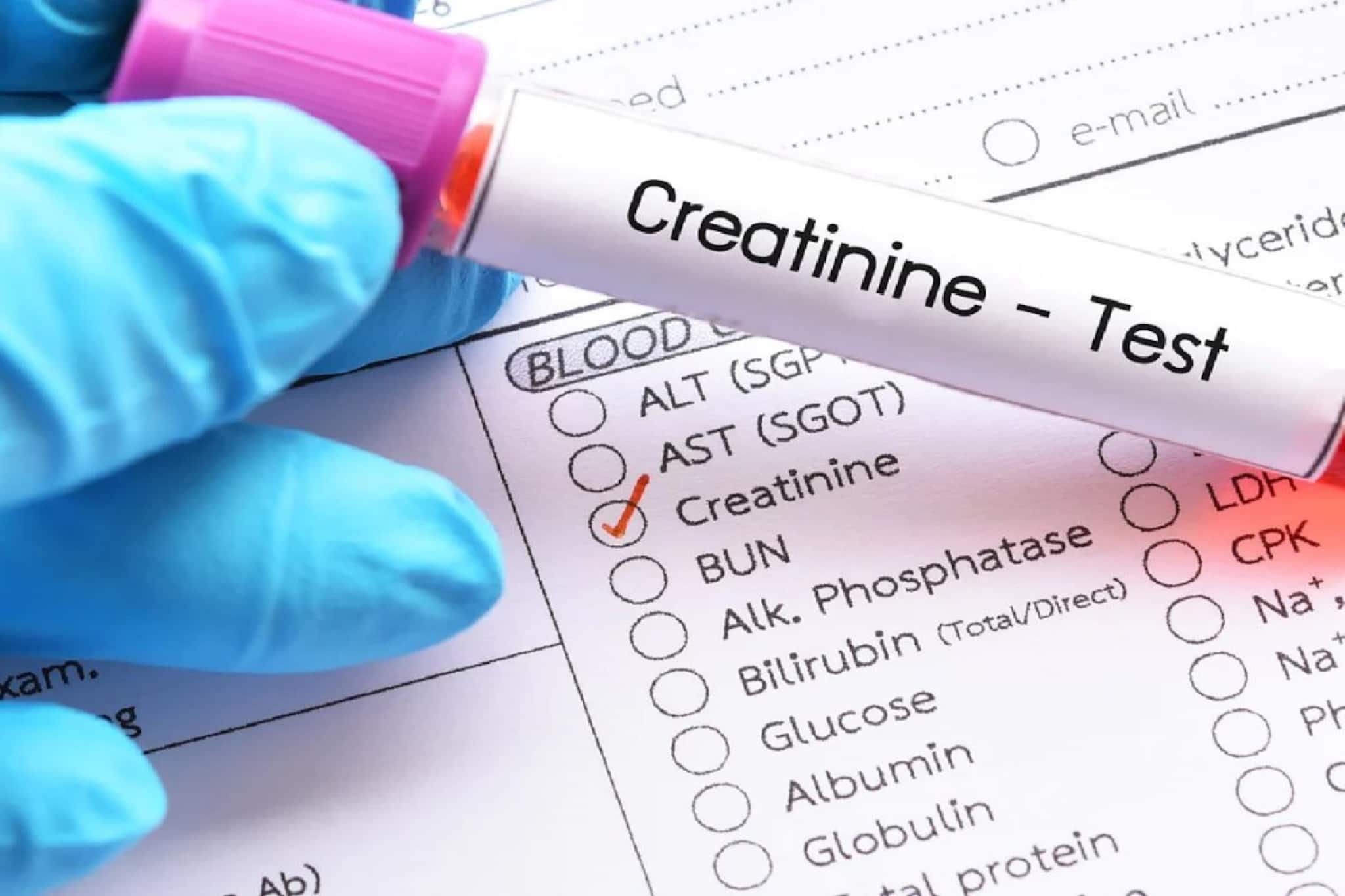 রক্তে 'ক্রিয়েটিনিন' বেশি মানেই নষ্ট হচ্ছে কিডনি! শরীরের কোন ৫ উপসর্গ বলে দেয় 'ক্রিয়েটিনিন' বেড়েছে? কিডনি সুস্থ রাখতে অবশ্যই জেনে নিন