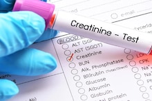 Creatinine: রক্তে 'ক্রিয়েটিনিন' বেশি মানেই নষ্ট হচ্ছে কিডনি! শরীরের কোন ৫ উপসর্গ বলে দেয় 'ক্রিয়েটিনিন' বেড়েছে? কিডনি সুস্থ রাখতে অবশ্যই জেনে নিন