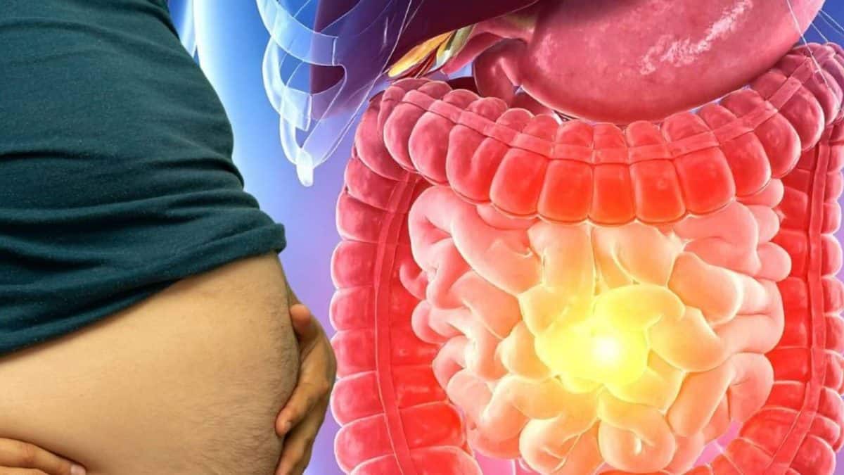 Bloating & Indigestion Home Remedies: হাফ চামচ জিরের সঙ্গে জাস্ট ২ টো জিনিস…মিশিয়ে খেলেই ভসভসিয়ে সাফ জমে থাকা গ্যাস অম্বল! বদহজমে ফোলা জয়ঢাক পেট চুপসে যাবে নিমেষে Bloating & Indigestion Home Remedies: হাফ চামচ জিরের সঙ্গে জাস্ট ২ টো জিনিস…মিশিয়ে খেলেই ভসভসিয়ে সাফ জমে থাকা গ্যাস অম্বল! বদহজমে ফোলা জয়ঢাক পেট চুপসে যাবে নিমেষে