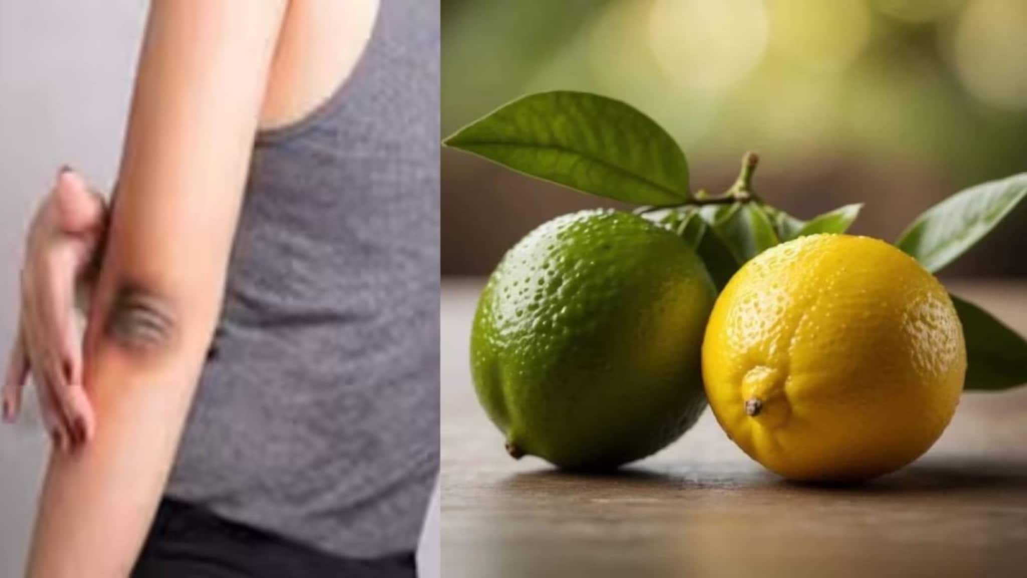 Dark Elbow Tips: দামি ক্রিম-লোশন কিনে মুঠো মুঠো টাকা জলে যাওয়ার দিন শেষ! পাতিলেবুর সঙ্গে ‘এটা’ মিশিয়ে মাখলেই পরিষ্কার হবে কুচকুচে কালো কনুই!