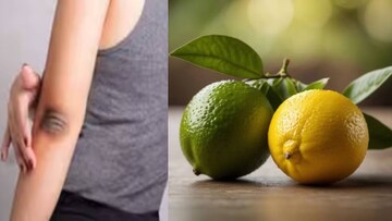 দামি ক্রিম-লোশন কিনে মুঠো মুঠো টাকা জলে যাওয়ার দিন শেষ! পাতিলেবুর সঙ্গে ‘এটা’ মিশিয়ে মাখলেই পরিষ্কার হবে কুচকুচে কালো কনুই