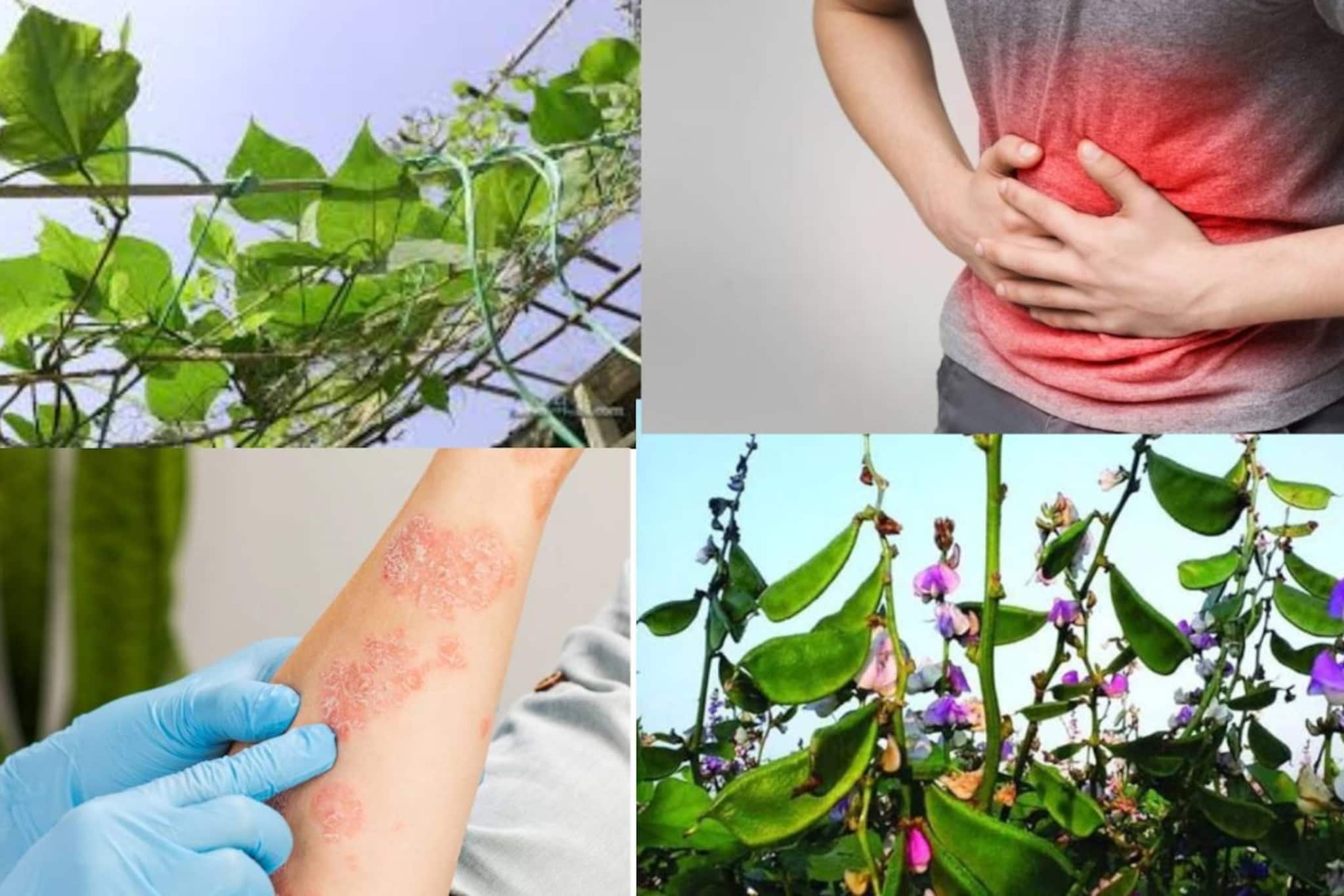 কোষ্ঠকাঠিন্য, পেটের রোগের সঙ্গেই সারায় চর্মরোগও! চরম সস্তা এই সবজির লতানে গাছের পাতা ওষুধের ভান্ডার!