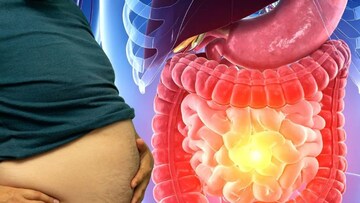 উপকারী হলেও এই ৪ সবজি, ২ ফল ও ১ ডাল গ্যাসের আড়ত! সেভাবে খেলেই পেট ফুলে জয়ঢাক! জেনে তবেই ফেলুন মুখে...