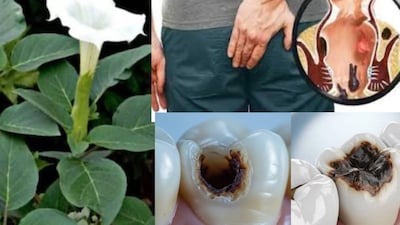 ধুতুরা এমন একটি উদ্ভিদ যার ফল, পাতা এবং কাণ্ড স্বাস্থ্যের জন্য উপকারী বলে মনে করা হয়। এতে স্কোপোলামিন, অ্যাট্রোপিন, অ্যানিসোডামিন, মেটেলয়েডিন এবং অ্যাঞ্জেলাইট এস্টারের মতো ট্রোপেন অ্যালকালয়েড রয়েছে, যা অনেক রোগ প্রতিরোধে সাহায্য করে বলে বিশ্বাস করা হয়। বলছেন আয়ুর্বেদিক পণ্ডিত দেবেন্দ্র কুমার৷