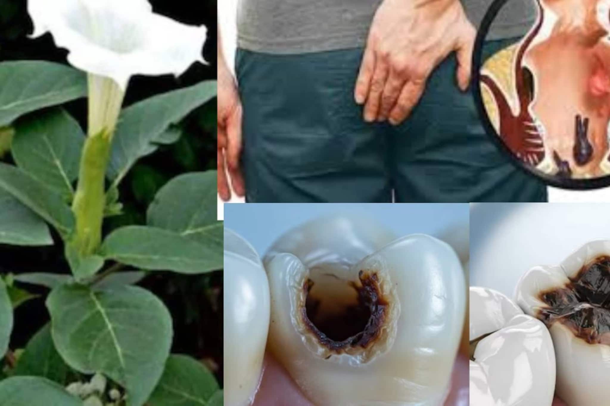 অর্শে পাতার ভস্ম বা পোকা খাওয়া দাঁতের গর্তে বীজের গুঁড়ো...‘বিষাক্ত’ গাছেই খতম ক্রনিক জ্বালা-যন্ত্রণা-ব্যথা