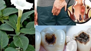 অর্শে পাতার ভস্ম বা পোকা খাওয়া দাঁতের গর্তে বীজের গুঁড়ো...‘বিষাক্ত’ গাছেই খতম ক্রনিক জ্বালা-যন্ত্রণা-ব্যথা