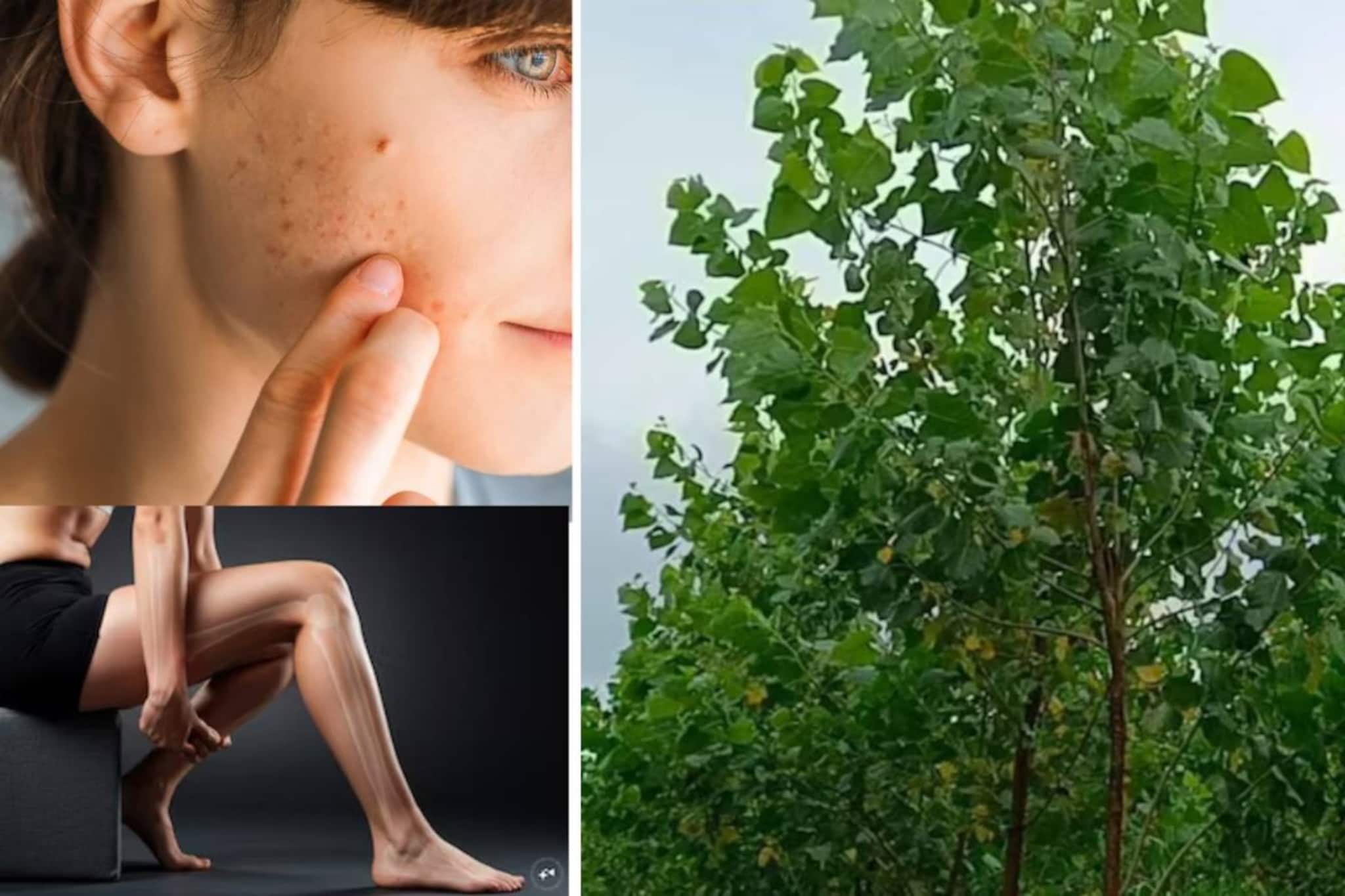 ব্রণ-চর্মরোগ-চুলকানি-গাঁটের ব্যথা থেকে শ্বাসকষ্ট! ষোল আনা ধন্বন্তরি...এই গাছের চাষ করলে মালামাল হবেন তুড়িতে!