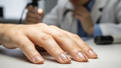 ক্যানসারের লক্ষণ 