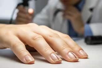 আপনার নখে কি 'এই' দাগ রয়েছে...! কিন্তু এটি প্রাণঘাতী ক্যানসারের লক্ষণ হতে পারে, আজই সাবধান হন