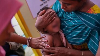 বাংলাদেশে হামের প্রকোপ (প্রতীকী ছবি) বাংলাদেশে হামের প্রকোপ (প্রতীকী ছবি)
