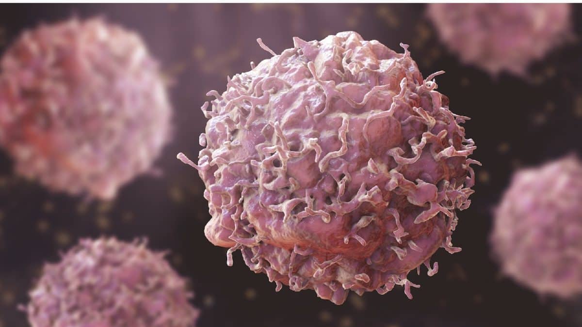 Prevent Cancer: আপনি জানেন না,আপনার রান্নাঘরেই গিজগিজ করছে ক্যানসারের ...