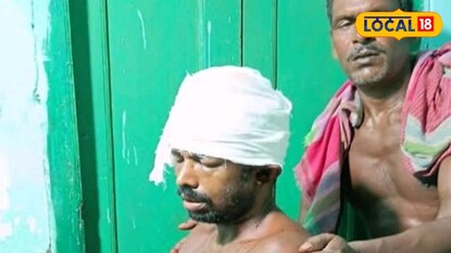 সুন্দরবনে বাঘের আক্রমণে আহত কুলতলির মৎস্যজীবী গোপাল নস্কর সুন্দরবনে বাঘের আক্রমণে আহত কুলতলির মৎস্যজীবী গোপাল নস্কর