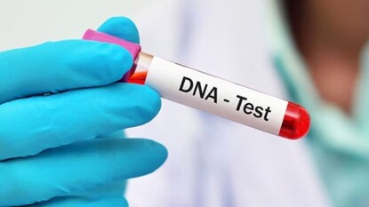 মজা করে করিয়েছিলেন DNA পরীক্ষা, প্রকাশ্যে এল মায়ের ২৩ বছর আগের গোপন রহস্য! মুহূর্তেই ভেঙে পড়ল গোটা পরিবার