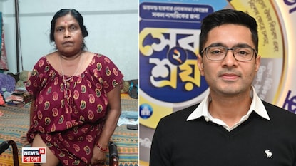 সেবাশ্রয় ক্যাম্পে ওষুধ খাওয়ার পরই পা বাদ দিতে হয়েছে, অভিযোগ মহেশতলার বাসিন্দা মালতী দাসের পরিবারের৷ সেবাশ্রয় ক্যাম্পে ওষুধ খাওয়ার পরই পা বাদ দিতে হয়েছে, অভিযোগ মহেশতলার বাসিন্দা মালতী দাসের পরিবারের৷