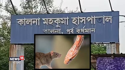 সাপের কামড়ে ৮ বছরের শিশুর মৃত্যুর আশঙ্কা সাপের কামড়ে ৮ বছরের শিশুর মৃত্যুর আশঙ্কা
