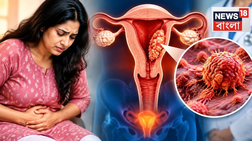 Endometrial Cancer Symptoms: ঋতুস্রাবের মাঝে বা মেনোপজের পরে ‘এটা’ হচ্ছে? তলপেটে এই ‘অস্বস্তি’? জরায়ুতে ছড়িয়েছে মারণরোগ? এন্ডোমেট্রিয়াল ক্যানসারের বিপদসঙ্কেত চিনুন Endometrial Cancer Symptoms: ঋতুস্রাবের মাঝে বা মেনোপজের পরে ‘এটা’ হচ্ছে? তলপেটে এই ‘অস্বস্তি’? জরায়ুতে ছড়িয়েছে মারণরোগ? এন্ডোমেট্রিয়াল ক্যানসারের বিপদসঙ্কেত চিনুন