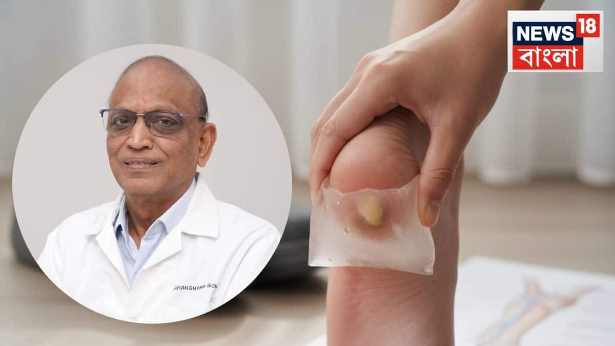 Heel Spur: গোড়ালির হাড়ে ‘কাঁটা’ বাড়ছে? কোন জুতো পরলে কমতে পারে ব্যথা? পায়ের পাতার নীচে কোন ‘কাজে’ যন্ত্রণার ছুটি? জানুন