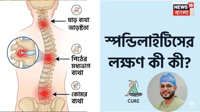 Spondylitis: Numbness, Neck Pain? Understand Causes & Remedies from Experts