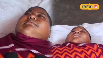 গুরুতর অসুস্থ হয়ে পড়ল মুর্শিদাবাদের বেলডাঙ্গার 'জলমানব' ইকবাল হোসেন