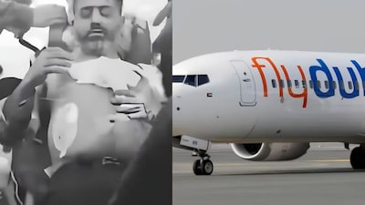 পাইলটের আহত হওয়ার পর প্রথম ছবি প্রকাশ্যে।