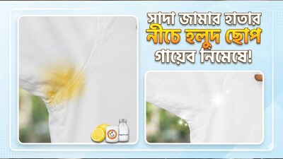সাদা শার্ট কার্যত প্রত্যেকের কর্মস্থলের পোশাকের একটি অপরিহার্য অংশ। অফিসে যাওয়া, মিটিংয়ে যোগ দেওয়া, বা কোনও বিশেষ অনুষ্ঠানে স্টাইলিশ দেখানোর জন্যই হোক না কেন, সাদা শার্ট সবসময়ই একটি ক্লাসিক পছন্দ। কিন্তু কখনও কখনও, বার বার পরা এবং ধোওয়ার পরেও শার্টের বাহুমূলের অংশে হলুদ দাগ পড়তে পারে। (AI Image)