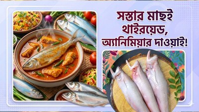 এই মাছের নাম শুনলে কারওর জিভ থেকে জল পড়ে। কারওর আবার নাক নিজের থেকেই কুঁচকে যায়। এমনই এক মাছ লটে বা লইট্টা। বাঙালদের একান্ত আপন বলে পরিচিত এই মাছ খেতে চান না অনেক এদেশীয় পরিবার। কিন্তু এই সামুদ্রিক মাছের উপকারিতা জানলে চমকে যাবেন। লইট্টা মানেই কিন্তু শুঁটকি মাছ নয়। এই মাছ দু’ভাবে খাওয়া যায়। একটা হল কাঁচা মাছ। যেটা সমুদ্র থেকে তোলার পর সরাসরি খাওয়া হয়। আর একটি হল সমুদ্রের তীরে কড়া রোদে শুকিয়ে শুকনো বা শুঁটকি করে খাওয়া। জেনে নিন কোনটায় পাবেন কী কী উপকারিতা। (AI Image)