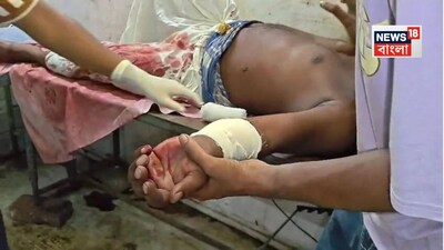 পেটে কাঁচি ঢুকিয়ে দিল