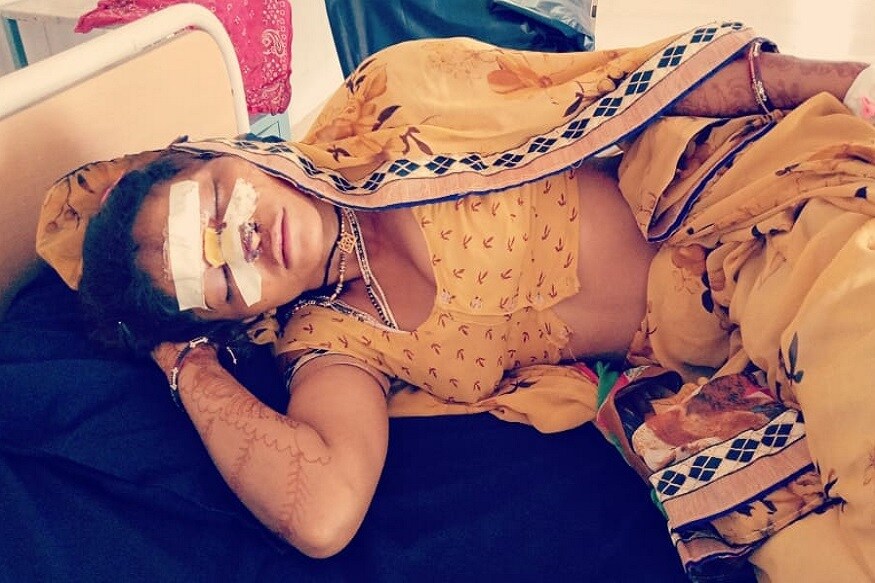 જૂન, 2018: પાટણના હારીજમાં સરેલ ગામે ઠાકોર વાસમાંથી જ્યારે દલિત મહિલા પસાર થઇ રહી હતી તે દરમિયાન અચાનક જ અજાણ્યા શખ્શોએ ત્રાટકી પડ્યા અને તેના મો પર ઘા ઝીંક્યા હતા. હુમલો એટલો ખતરનાક હતો કે તેમના મો પર 6 ટાંકા આવ્યા હતા. જૂન, 2018: પાટણના હારીજમાં સરેલ ગામે ઠાકોર વાસમાંથી જ્યારે દલિત મહિલા પસાર થઇ રહી હતી તે દરમિયાન અચાનક જ અજાણ્યા શખ્શોએ ત્રાટકી પડ્યા અને તેના મો પર ઘા ઝીંક્યા હતા. હુમલો એટલો ખતરનાક હતો કે તેમના મો પર 6 ટાંકા આવ્યા હતા.