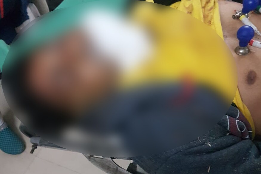 સામેથી આવી રહેલી રિક્ષા સાથે કાર ટકરાતા શેરસિયા ઇલમુદ્દીન અને શેરસિયા હુસેનભાઇનું ઘટનાસ્થળે જ મોત નિપજ્યું હતું. અકસ્માતને પગલે સ્થાનિક લોકો ઘટનાસ્થળે દોડી આવ્યા હતા અને પોલીસને ઘટના અંગે જાણ કરી હતી. સ્થાનિક લોકોએ અકસ્માતમાં ઘાયલ ત્રણ લોકોને મોરબીની સિવિલ હોસ્પિટલમાં ખસેડ્યા હતા. સામેથી આવી રહેલી રિક્ષા સાથે કાર ટકરાતા શેરસિયા ઇલમુદ્દીન અને શેરસિયા હુસેનભાઇનું ઘટનાસ્થળે જ મોત નિપજ્યું હતું. અકસ્માતને પગલે સ્થાનિક લોકો ઘટનાસ્થળે દોડી આવ્યા હતા અને પોલીસને ઘટના અંગે જાણ કરી હતી. સ્થાનિક લોકોએ અકસ્માતમાં ઘાયલ ત્રણ લોકોને મોરબીની સિવિલ હોસ્પિટલમાં ખસેડ્યા હતા.