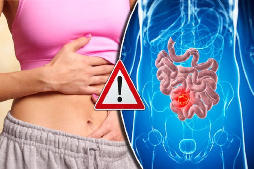 Home Remedies for Constipation: - નિયમિત વૉકિંગની આદત પાડો. વહેલા ઉઠો અને તીવ્ર ઝડપથી 20 થી 30 મિનિટ સુધી ચાલો. Home Remedies for Constipation: - નિયમિત વૉકિંગની આદત પાડો. વહેલા ઉઠો અને તીવ્ર ઝડપથી 20 થી 30 મિનિટ સુધી ચાલો.