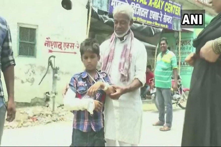 બિહારની દરભંગા હોસ્પિટલ (ડીએમસીએચ)ની બેદરકારી સામે આવી છે. બિહારના દરભંગા મેડિકલ કોલેજ તથા હોસ્પિટલમાં એક બાળકનો ડાબો હાથ તૂટી જતા તેના જમણા હાથ પર પ્લાસ્ટર ચઢાવી દેવાયુ હતુ. DMCHમાં માત્ર બિહાર જ નહીં નેપાળના લોકો પણ સારવાર માટે આવે છે. બિહારની જાણીતા હોસ્પિટલ ડીએમચીએચના ડોક્ટરની મોટી બેદરકારીની તસવીરો જુઓ. બિહારની દરભંગા હોસ્પિટલ (ડીએમસીએચ)ની બેદરકારી સામે આવી છે. બિહારના દરભંગા મેડિકલ કોલેજ તથા હોસ્પિટલમાં એક બાળકનો ડાબો હાથ તૂટી જતા તેના જમણા હાથ પર પ્લાસ્ટર ચઢાવી દેવાયુ હતુ. DMCHમાં માત્ર બિહાર જ નહીં નેપાળના લોકો પણ સારવાર માટે આવે છે. બિહારની જાણીતા હોસ્પિટલ ડીએમચીએચના ડોક્ટરની મોટી બેદરકારીની તસવીરો જુઓ.