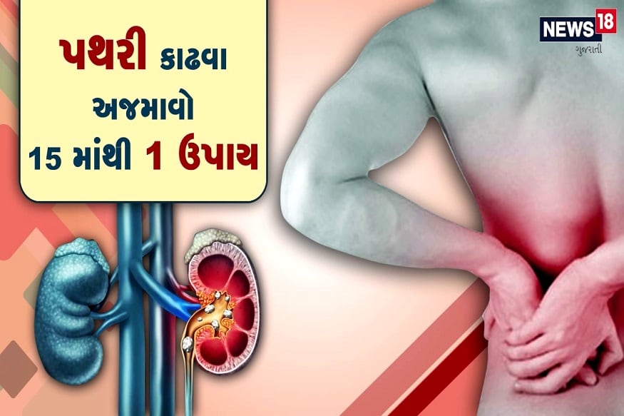 પથરીમાં થતા દુખાવોનો દર્દ તે દર્દી જ જાણી શકે છે, પથરીની અસહ્ય પીડામાંથી મુક્તિ અપાવતી 15 ટીપ્સ પથરીમાં થતા દુખાવોનો દર્દ તે દર્દી જ જાણી શકે છે, પથરીની અસહ્ય પીડામાંથી મુક્તિ અપાવતી 15 ટીપ્સ