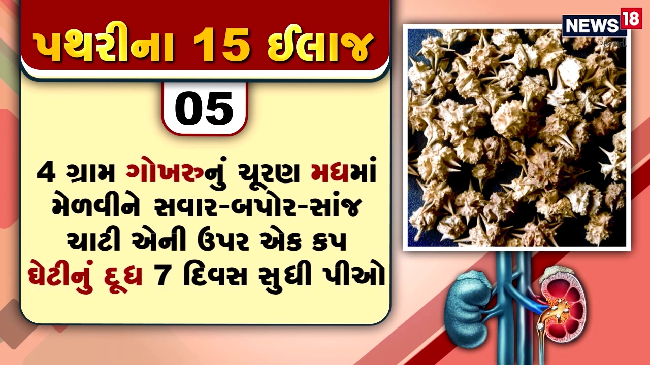 પથરીમાં થતા દુખાવોનો દર્દ તે દર્દી જ જાણી શકે છે, પથરીની અસહ્ય પીડામાંથી મુક્તિ અપાવતી 15 ટીપ્સ પથરીમાં થતા દુખાવોનો દર્દ તે દર્દી જ જાણી શકે છે, પથરીની અસહ્ય પીડામાંથી મુક્તિ અપાવતી 15 ટીપ્સ