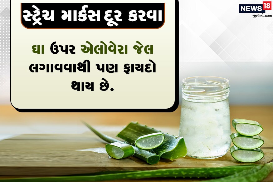 સ્ટ્રેચ માર્કસ્ દૂર કરવા<br />એલોવેરા જેલમાં ગુલાબજળ ભેળવી લગાવવાથી ફાયદો થશે.<br />ઘા ઉપર એલોવેરા જેલ લગાવવાથી પણ ફાયદો થાય છે. સ્ટ્રેચ માર્કસ્ દૂર કરવા<br />એલોવેરા જેલમાં ગુલાબજળ ભેળવી લગાવવાથી ફાયદો થશે.<br />ઘા ઉપર એલોવેરા જેલ લગાવવાથી પણ ફાયદો થાય છે.