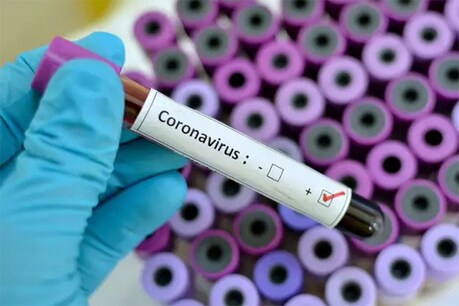 Coronavirus cure: કોરોના વાયરસ સામે ડર નહીં, સાવચેતી જરૂરી; ગુજરાતમાં આટલી જગ્યાએ સારવાર ઉપલબ્ધ Coronavirus cure: કોરોના વાયરસ સામે ડર નહીં, સાવચેતી જરૂરી; ગુજરાતમાં આટલી જગ્યાએ સારવાર ઉપલબ્ધ