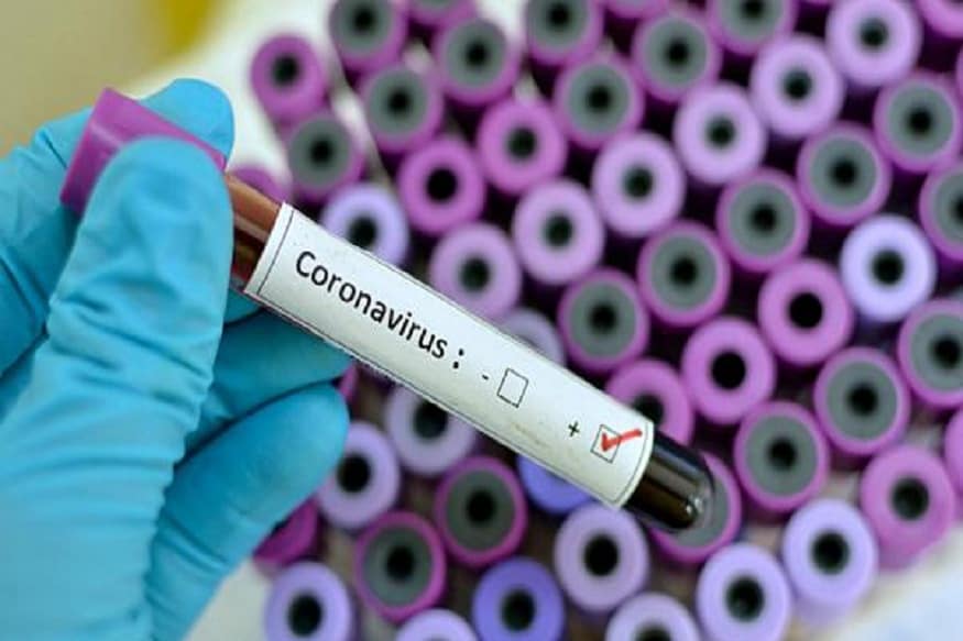 નવી દિલ્હીઃ કોરોના વાયરસ મહામામરી (Coronavirus Pandemic)ના વધતા પ્રકોપ જોતા તાજેતરમાં રિલાયન્સ જનરલ ઈન્શ્યોરન્સ (Reliance Genral Insurance)સે એક નવી COVID-19 ઈન્શ્યોરન્સ સ્કીમ લોન્ચ કરી છે. કોઈપણ વ્યક્તિ કોરોના વાયરસ ટેસ્ટમાં પોઝિટીવ મળે તો તેને આ ઈન્શ્યોરન્સ પોલિસી અંતર્ગત લાભ મળશે. આ પ્લાન અંતર્ગત તેને 100 ટકા અશ્યોર્ડ રકમ મળશે. સાથે સાથે પે કટ પણ કવર થશે. (પ્રતિકાત્મક તસવીર) નવી દિલ્હીઃ કોરોના વાયરસ મહામામરી (Coronavirus Pandemic)ના વધતા પ્રકોપ જોતા તાજેતરમાં રિલાયન્સ જનરલ ઈન્શ્યોરન્સ (Reliance Genral Insurance)સે એક નવી COVID-19 ઈન્શ્યોરન્સ સ્કીમ લોન્ચ કરી છે. કોઈપણ વ્યક્તિ કોરોના વાયરસ ટેસ્ટમાં પોઝિટીવ મળે તો તેને આ ઈન્શ્યોરન્સ પોલિસી અંતર્ગત લાભ મળશે. આ પ્લાન અંતર્ગત તેને 100 ટકા અશ્યોર્ડ રકમ મળશે. સાથે સાથે પે કટ પણ કવર થશે. (પ્રતિકાત્મક તસવીર)