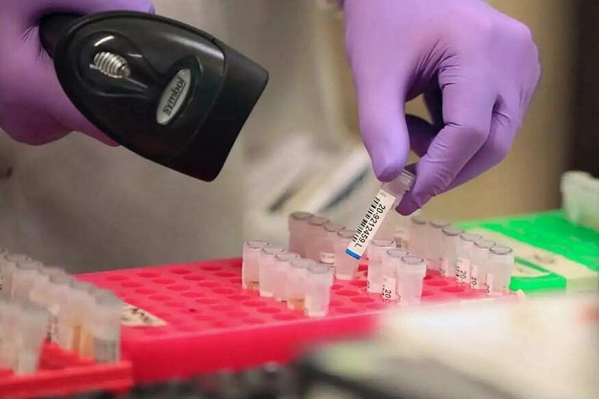 મેલબર્નઃ કોરોના વાયરસ (Coronavirus)થી સંક્રમિત દર્દીઓની સંખ્યા દુનિયાભરમાં ઝડપથી વધી રહી છે. અત્યાર સુધી 12 લાખથી વધુ લોકો કોરોના વાયરસ (COVID-19)થી સંક્રમિત થઈ ચૂક્યા છે, જ્યારે 64 હજારથી વધુ લોકોનાં મોત થઈ ચૂક્યા છે. દુનિયાભરના વૈજ્ઞાનિકો કોરોના વાયરસના સંક્રમણને ખતમ કરવા માટે વેક્સીન (Corona Vaccine) બનાવવામાં લાગી ગયા છે. મેલબર્નઃ કોરોના વાયરસ (Coronavirus)થી સંક્રમિત દર્દીઓની સંખ્યા દુનિયાભરમાં ઝડપથી વધી રહી છે. અત્યાર સુધી 12 લાખથી વધુ લોકો કોરોના વાયરસ (COVID-19)થી સંક્રમિત થઈ ચૂક્યા છે, જ્યારે 64 હજારથી વધુ લોકોનાં મોત થઈ ચૂક્યા છે. દુનિયાભરના વૈજ્ઞાનિકો કોરોના વાયરસના સંક્રમણને ખતમ કરવા માટે વેક્સીન (Corona Vaccine) બનાવવામાં લાગી ગયા છે.