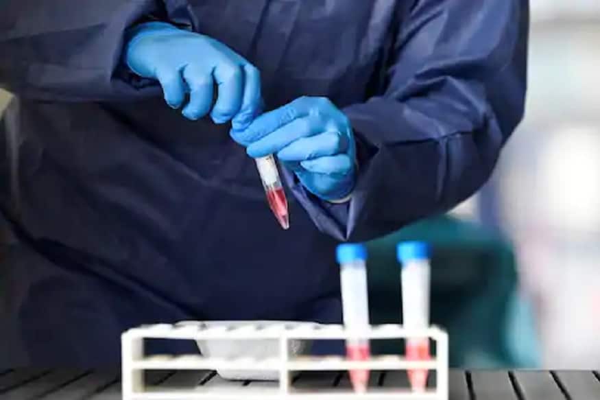 Coronavirus Reserch : કોરોના વાયરસે અત્યાર સુધી દુનિયાભરના 66 લાખ લોકોને પોતાની ઝપેટમાં લઇ લીધા છે. અત્યાર સુધીમાં આ વાયરસના કારણે 3 લાખ 89 હજાર લોકોની મોત થઇ છે અને આ આંકડો વધી રહ્યો છે. સામાન્ય રીકે કોરોનામાં દર્દીને શ્વાસ લેવામાં તકલીફ થાય છે. જે સ્થિતિ વધતા પાછળથી તેની મોત પણ થઇ શકે છે. એક નવા રિસર્ચમાં તેવો દાવો કરવામાં આવ્યો છે કે તમારા બલ્ડ ગ્રુપ પર આધાર રાખે છે કે શ્વાસ લેવામાં કેટલી મુશ્કેલીઓ આવી શકે છે. વધુમાં આ રિસર્ચે તેવો પણ દાવો કર્યો છે કે આ બલ્ડગ્રુપના લોકોને કોરોનાથી સૌથી વધુ ખતરો છે. Coronavirus Reserch : કોરોના વાયરસે અત્યાર સુધી દુનિયાભરના 66 લાખ લોકોને પોતાની ઝપેટમાં લઇ લીધા છે. અત્યાર સુધીમાં આ વાયરસના કારણે 3 લાખ 89 હજાર લોકોની મોત થઇ છે અને આ આંકડો વધી રહ્યો છે. સામાન્ય રીકે કોરોનામાં દર્દીને શ્વાસ લેવામાં તકલીફ થાય છે. જે સ્થિતિ વધતા પાછળથી તેની મોત પણ થઇ શકે છે. એક નવા રિસર્ચમાં તેવો દાવો કરવામાં આવ્યો છે કે તમારા બલ્ડ ગ્રુપ પર આધાર રાખે છે કે શ્વાસ લેવામાં કેટલી મુશ્કેલીઓ આવી શકે છે. વધુમાં આ રિસર્ચે તેવો પણ દાવો કર્યો છે કે આ બલ્ડગ્રુપના લોકોને કોરોનાથી સૌથી વધુ ખતરો છે.