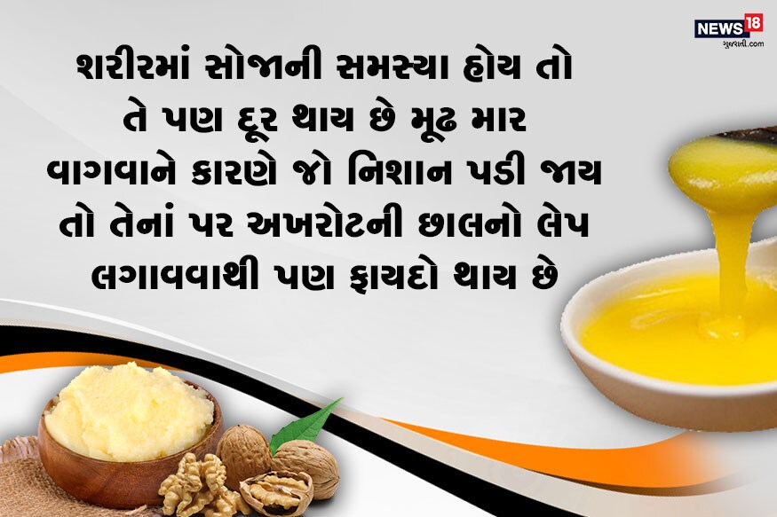 શરીરમાં સોજાની સમસ્યા હોય તો તે પણ દૂર થાય છે મૂઢ માર વાગવાને કારણે જો નિશાન પડી જાય તો તેનાં પર અખરોટની છાલનો લેપ લગાવવાથી પણ ફાયદો થાય છે. શરીરમાં સોજાની સમસ્યા હોય તો તે પણ દૂર થાય છે મૂઢ માર વાગવાને કારણે જો નિશાન પડી જાય તો તેનાં પર અખરોટની છાલનો લેપ લગાવવાથી પણ ફાયદો થાય છે.