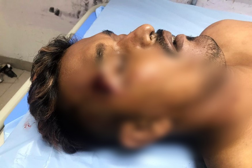 ત્રણ દિવસમાં ત્રીજી હત્યા થતા સુરત શહેરમાં ચકચાર મચી જવા પામી છે. બનાવની વિગત એવી છે કે ડીંડોલીના ભેસ્તાન આવાસમાં ઈમરાન ઉર્ફે બુઢાવ નામના એક શખ્સની માથાભારે તરીકેની છાપ હતી. દરમિયાન ગઈકાલે રાત્રે ભેસ્તાનના પાંજરાપોળ પાસે તેના પર હુમલો કરવામાં આવ્યો હતો. ત્રણ દિવસમાં ત્રીજી હત્યા થતા સુરત શહેરમાં ચકચાર મચી જવા પામી છે. બનાવની વિગત એવી છે કે ડીંડોલીના ભેસ્તાન આવાસમાં ઈમરાન ઉર્ફે બુઢાવ નામના એક શખ્સની માથાભારે તરીકેની છાપ હતી. દરમિયાન ગઈકાલે રાત્રે ભેસ્તાનના પાંજરાપોળ પાસે તેના પર હુમલો કરવામાં આવ્યો હતો.