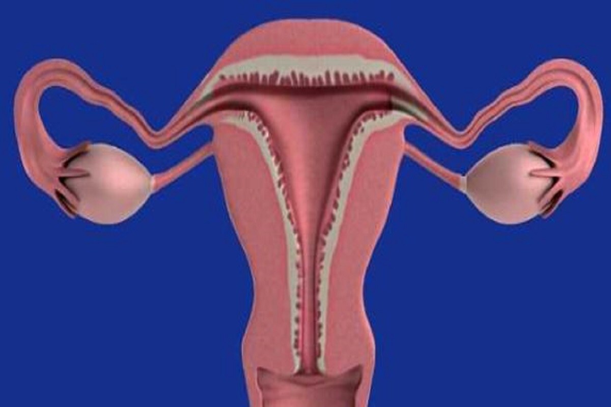 PCOS વાળી મહિલાઓમાં, તેમનું અંડાશય સંપૂર્ણપણે વિકસિત નથી થતું. તેમને નિયમિત ઓવુલેશન ચક્ર દરમિયાન ઇંડુ રિલીઝ કરવામાં સમસ્યા આવે છે. તેનાંથી માસિક અનિયમિત થઇ જાય છે. PCOS વાળી મહિલાઓમાં, તેમનું અંડાશય સંપૂર્ણપણે વિકસિત નથી થતું. તેમને નિયમિત ઓવુલેશન ચક્ર દરમિયાન ઇંડુ રિલીઝ કરવામાં સમસ્યા આવે છે. તેનાંથી માસિક અનિયમિત થઇ જાય છે.
