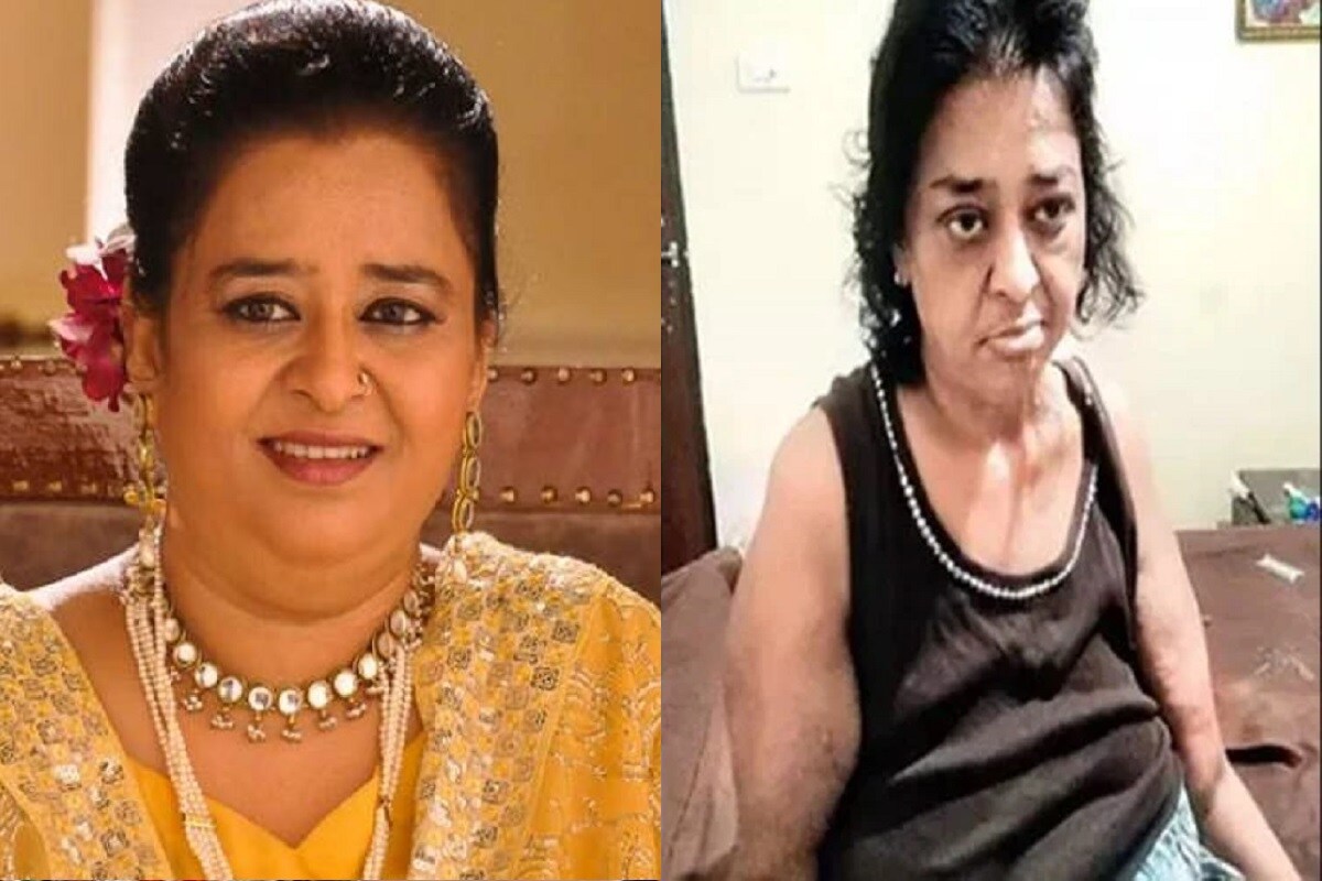 મુંબઇ: ટીવી એક્ટ્રેસ નિશી સિંહ ભાદલી (Nishi Singh Bhadli) ફેબ્રુઆરી, 2019માં સ્વાસ્થ્ય સંબંધિત ગંભીર સમસ્યાઓનો શીકાર થઇ હતી. હવે દવાઓ પર થનારો ખર્ચો એટલો વધી ગયો છે કે પરિવારે આર્થિક મદદ માટે હાથ લંબાવ્યો છે. મુંબઇ: ટીવી એક્ટ્રેસ નિશી સિંહ ભાદલી (Nishi Singh Bhadli) ફેબ્રુઆરી, 2019માં સ્વાસ્થ્ય સંબંધિત ગંભીર સમસ્યાઓનો શીકાર થઇ હતી. હવે દવાઓ પર થનારો ખર્ચો એટલો વધી ગયો છે કે પરિવારે આર્થિક મદદ માટે હાથ લંબાવ્યો છે.