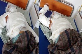 અમદાવાદમાં Acid attack: 30 વર્ષના લગ્નજીવન બાદ પતિની ક્રૂર ભડાશ, પત્ની પર ફેંક્યું એસિડ