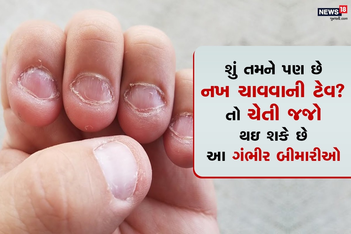 એન્ટરટેઇનમેન્ટ ડેસ્ક: ઘણા લોકોને નખ ચાવવાની ટેવ હોય છે ઘણાં પ્રયાસો કરવા છતાં આ આદત છુટતી નથી પણ જો આ ટેવ કેટલી ઘાતક નીવડી શકે છે તમે જાણોછો, નખ ચાવવાથી ઘણાં પ્રકારનાં રોગ થઇ શકે છે એટલું જ નહીં આ ટેવ શરીરને રોગનું ઘર બનાવી દે છે. તેથી જ જો તમે પણ ન ચાહો છો, તો આજથી તમારે બંધ કરી દેવું જોઈએ. એન્ટરટેઇનમેન્ટ ડેસ્ક: ઘણા લોકોને નખ ચાવવાની ટેવ હોય છે ઘણાં પ્રયાસો કરવા છતાં આ આદત છુટતી નથી પણ જો આ ટેવ કેટલી ઘાતક નીવડી શકે છે તમે જાણોછો, નખ ચાવવાથી ઘણાં પ્રકારનાં રોગ થઇ શકે છે એટલું જ નહીં આ ટેવ શરીરને રોગનું ઘર બનાવી દે છે. તેથી જ જો તમે પણ ન ચાહો છો, તો આજથી તમારે બંધ કરી દેવું જોઈએ.