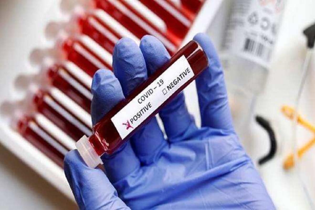 દેશભરમાં (India) કોરોનાના કેસ (coronvirus) વધી રહ્યાં છે આ સાથે ગુજરાતમાં (Gujarat) પણ કોરોનાનો કહેર વધી રહ્યો છે. ત્યારે કેન્દ્રની નરેન્દ્ર મોદી સરકાર દ્વારા ગુજરાતમાં નિષ્ણાતોની ટીમ મોકલવામાં આવી હતી. કેન્દ્રની ટીમના સૂચનો મુજબ રાજ્ય સરકારના આરોગ્ય વિભાગ દ્વારા નવી ગાઇડલાઇન (corona new Guidelines) બહાર પાડવામાં આવી છે. આ નવી ગાઇડલાઇન પ્રમાણે રેપિડ એન્ટિજન (Rapid antigen) નેગેટિવ હોય તેવા સિમ્પ્ટોમેટિક દર્દીઓનો RT PCRટેસ્ટ અવશ્ય કરાવવાનો રહેશે. જે દર્દી સિમ્પ્ટોમેટિક હોય અને રેપિડ એન્ટિજન (Rapid) તેમજ RT PCR બંને ટેસ્ટ રિપોર્ટ નેગેટિવ આવે તો તેણે સ્વાઇન ફ્લૂ (Swine flu) માટેનો ટેસ્ટ કરાવવાનો રહેશે. દેશભરમાં (India) કોરોનાના કેસ (coronvirus) વધી રહ્યાં છે આ સાથે ગુજરાતમાં (Gujarat) પણ કોરોનાનો કહેર વધી રહ્યો છે. ત્યારે કેન્દ્રની નરેન્દ્ર મોદી સરકાર દ્વારા ગુજરાતમાં નિષ્ણાતોની ટીમ મોકલવામાં આવી હતી. કેન્દ્રની ટીમના સૂચનો મુજબ રાજ્ય સરકારના આરોગ્ય વિભાગ દ્વારા નવી ગાઇડલાઇન (corona new Guidelines) બહાર પાડવામાં આવી છે. આ નવી ગાઇડલાઇન પ્રમાણે રેપિડ એન્ટિજન (Rapid antigen) નેગેટિવ હોય તેવા સિમ્પ્ટોમેટિક દર્દીઓનો RT PCRટેસ્ટ અવશ્ય કરાવવાનો રહેશે. જે દર્દી સિમ્પ્ટોમેટિક હોય અને રેપિડ એન્ટિજન (Rapid) તેમજ RT PCR બંને ટેસ્ટ રિપોર્ટ નેગેટિવ આવે તો તેણે સ્વાઇન ફ્લૂ (Swine flu) માટેનો ટેસ્ટ કરાવવાનો રહેશે.