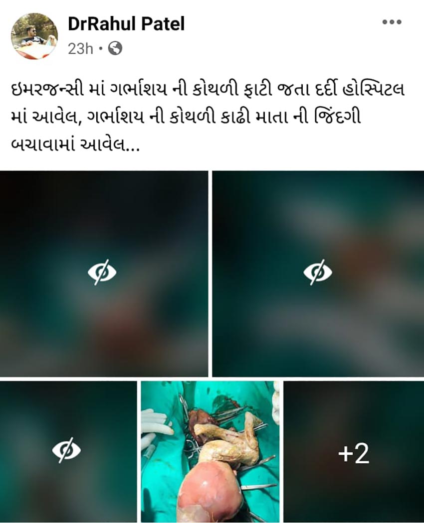 ડૉક્ટરને નોટિસ પાઠવવામાં આવશે: આ મામલે પાલનપુર સિવિલ હૉસ્પિટલના સુપ્રિન્ટેન્ડેન્ટ ભરત મિસ્ત્રીએ ન્યૂઝ18 ગુજરાતી સાથેની વાતચીતમાં જણાવ્યું હતું કે, "ઑપરેશન દરમિયાનના ફોટો ડૉક્ટર કે અન્ય કોઈ વ્યક્તિએ સોશિયલ મીડિયામાં વાયરસ કર્યા છે. આ કેસમાં ડૉક્ટરને નોટિસ પાઠવીને ખુલાસો પૂછવામાં આવશે. આ મામલે અમને કોઈ યોગ્ય પ્રત્યુતર નહીં મળે તો ડૉક્ટર સામે પગલાં લેવામાં આવશે." ડૉક્ટરને નોટિસ પાઠવવામાં આવશે: આ મામલે પાલનપુર સિવિલ હૉસ્પિટલના સુપ્રિન્ટેન્ડેન્ટ ભરત મિસ્ત્રીએ ન્યૂઝ18 ગુજરાતી સાથેની વાતચીતમાં જણાવ્યું હતું કે, "ઑપરેશન દરમિયાનના ફોટો ડૉક્ટર કે અન્ય કોઈ વ્યક્તિએ સોશિયલ મીડિયામાં વાયરસ કર્યા છે. આ કેસમાં ડૉક્ટરને નોટિસ પાઠવીને ખુલાસો પૂછવામાં આવશે. આ મામલે અમને કોઈ યોગ્ય પ્રત્યુતર નહીં મળે તો ડૉક્ટર સામે પગલાં લેવામાં આવશે."
