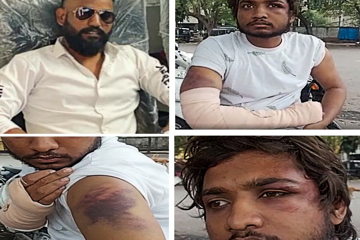કિર્તેશ પટેલ, સુરત : સુરત શહેરમાં (Surat Crime) જાણે લુખ્ખા તત્વોએ શહેરને બાનમાં લઈને અંધારી આલમનું રાજ સ્થાપી દીધું હોય તેવી ઘટનાઓ સામે આવી રહી છે. રોજ રોજ હત્યા અને હત્યાના પ્રયાસો અને જીવલેણ હુમલાઓની હારમાળાથી રાજ્યની આર્થિક રાજધાની સુરત હચમચી ગઈ છે. દરમિયાન શહેરના લુખ્ખા તત્વ સમાન લાલુ જાલીમને (Lalu Jalim Gang Surat) ગેંગેનો આતંક સામે આવ્યો છે. આ ગેંગ દ્વારા કતારગામમાં મિલકત પચાવવા માટે વેપારીના પુત્રનું અપહરણ કરી અને તેને ઢોર માર મારી ફ્રેકચર કરી અને છોડી મૂકવામાં આવ્યો છે. કિર્તેશ પટેલ, સુરત : સુરત શહેરમાં (Surat Crime) જાણે લુખ્ખા તત્વોએ શહેરને બાનમાં લઈને અંધારી આલમનું રાજ સ્થાપી દીધું હોય તેવી ઘટનાઓ સામે આવી રહી છે. રોજ રોજ હત્યા અને હત્યાના પ્રયાસો અને જીવલેણ હુમલાઓની હારમાળાથી રાજ્યની આર્થિક રાજધાની સુરત હચમચી ગઈ છે. દરમિયાન શહેરના લુખ્ખા તત્વ સમાન લાલુ જાલીમને (Lalu Jalim Gang Surat) ગેંગેનો આતંક સામે આવ્યો છે. આ ગેંગ દ્વારા કતારગામમાં મિલકત પચાવવા માટે વેપારીના પુત્રનું અપહરણ કરી અને તેને ઢોર માર મારી ફ્રેકચર કરી અને છોડી મૂકવામાં આવ્યો છે.